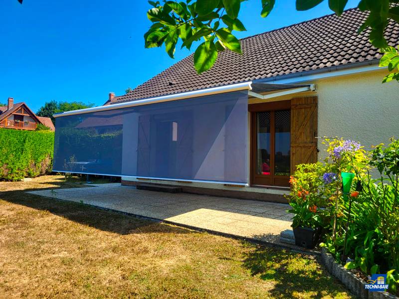 Installation d'un store banne sur mesure près d'Yvetot 76 en Seine Maritime